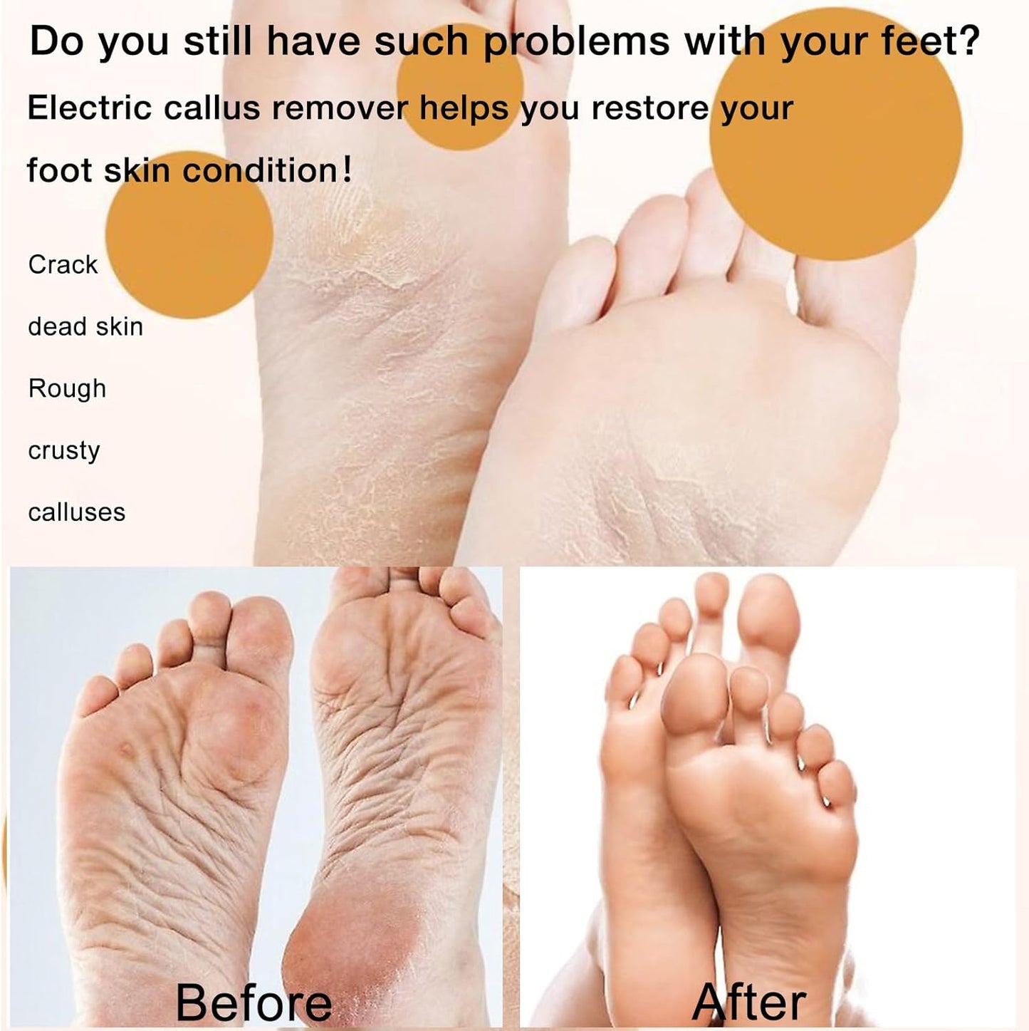 🦶 Mini Ponceuse Électrique pour Pédicure – Votre alliée beauté pour des pieds doux et impeccables à la maison !