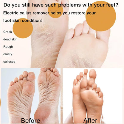 🦶 Mini Ponceuse Électrique pour Pédicure – Votre alliée beauté pour des pieds doux et impeccables à la maison !