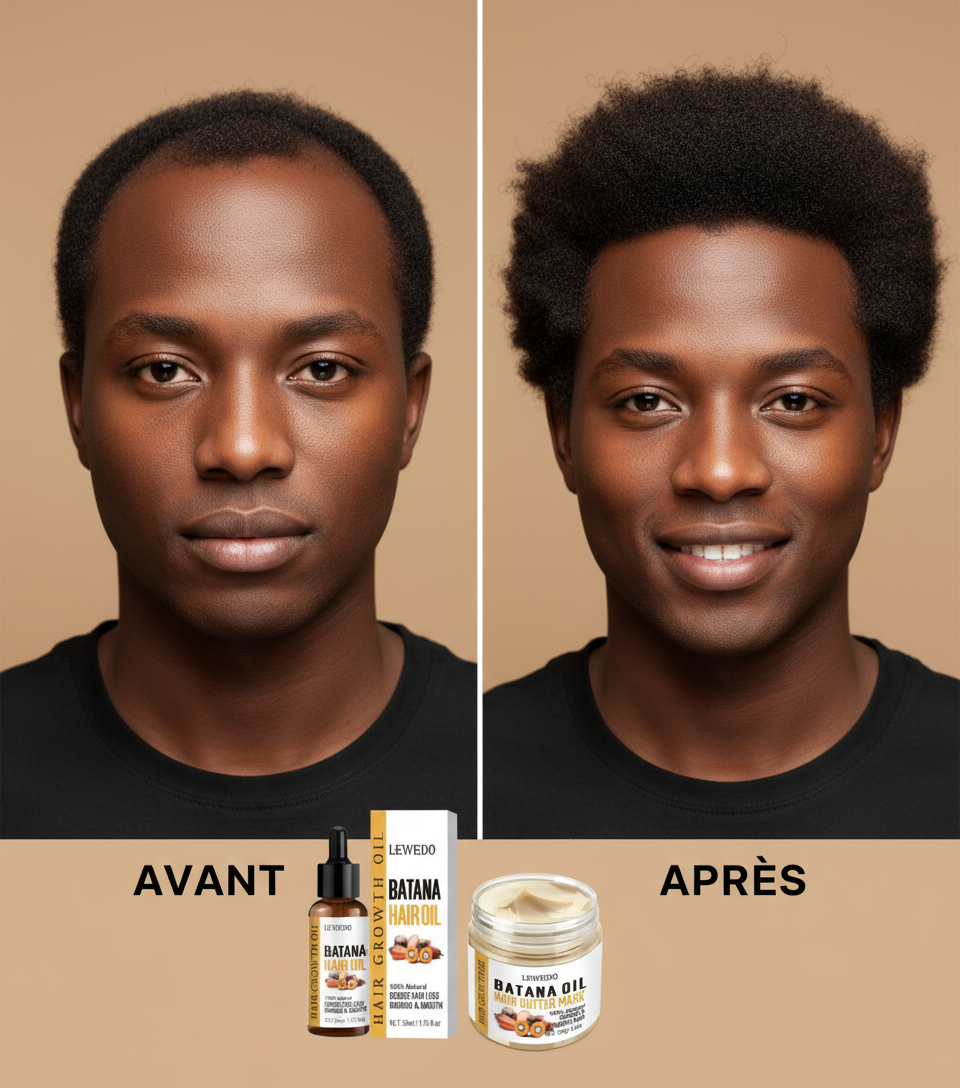Avant/Après homme - Repousse cheveux